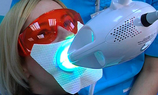 Отбеливание зубов: технология Zoom