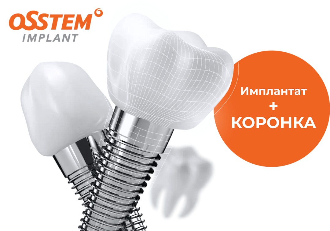 Имплант Osstem (Южная Корея)<br>+ коронка<br>за 38000₽